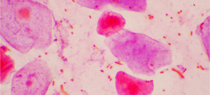 How to Extract RNA from Hard-to-Lyse Samples in Trizol<sup>®</sup>