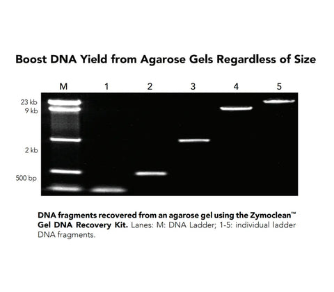 Zymoclean Gel DNA Recovery Kit